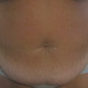 Frontal shot of the gut