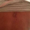 Entry point for back lipo but the sterile dressing got stuck to my skin, had to rip off :-(