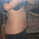 belly one week pre-op