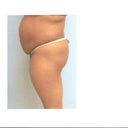 Before pics