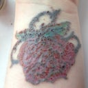 4 days after 3rd session, healing nicely!