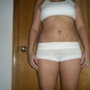 3 weeks post op