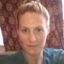 day6- all dark spots are gone!!! so so happy with the procedure:)