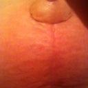 6.5 weeks, right side under