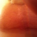 6.5 weeks, left side under