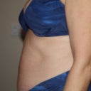 UGH!  Profile prior to tt