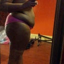 20 Days Post Op