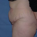 Other side, before.  Part of my wonders with this gigantic jiggly rear end if it's even worth it... but here we go!  :)