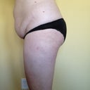 Left Side
