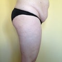 Right Side