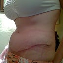 Scar 4/9