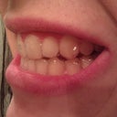 Day 1- the "buttons"