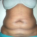 Before, front