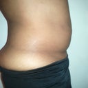 Before side view!