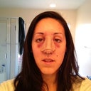 Day one after surgery