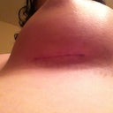 lefty scar.