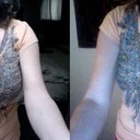 Before and After