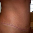 10 weeks
