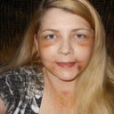 This is one of my after pictures. I had my surgery on August 7th 2012