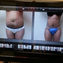 This is my PO Day 6 before and after pics