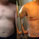 Before and Day after surgery.