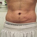 5 weeks, closer shot