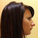 Side profile of how large I think my nose is for my face.