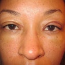 12/30 - 8 days after