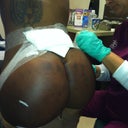 just got the garment off and removing the tape and stuff