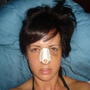 6th day after surgery