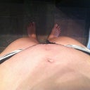 Still swollen- three weeks