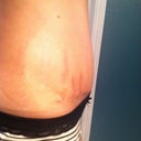 Still swollen- three weeks
