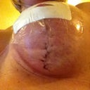 close up on scars