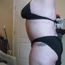 14 weeks post op