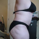 14 weeks post op