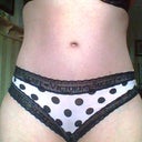 2 mo. PO, underwear disguises scar easily