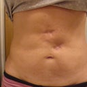 May 2011 this is my tummy today.