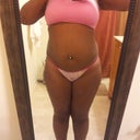 Before my second brazilian butt lift