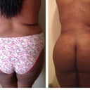 Before and after. Wow. Btw those are maternity panties I have on in the before pic, smh.