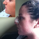 Before and After Profile