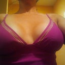 post-op 10 wks
