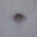 BB close up. You can see my circular scar but it is already turning white.