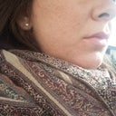 one month post treatment four weeks until second treatment