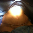 still in surgery, pretty flat! yay