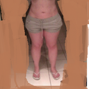 stomach view. Dr. Salama says im still swollen.
