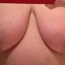 Before 36 g