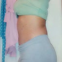 Side View 7 wks PO- Flatter