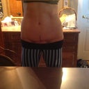 4 months po scar---very low but still red and swelling above?