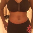 11 weeks post-op