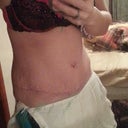 4wks 6 days half turned